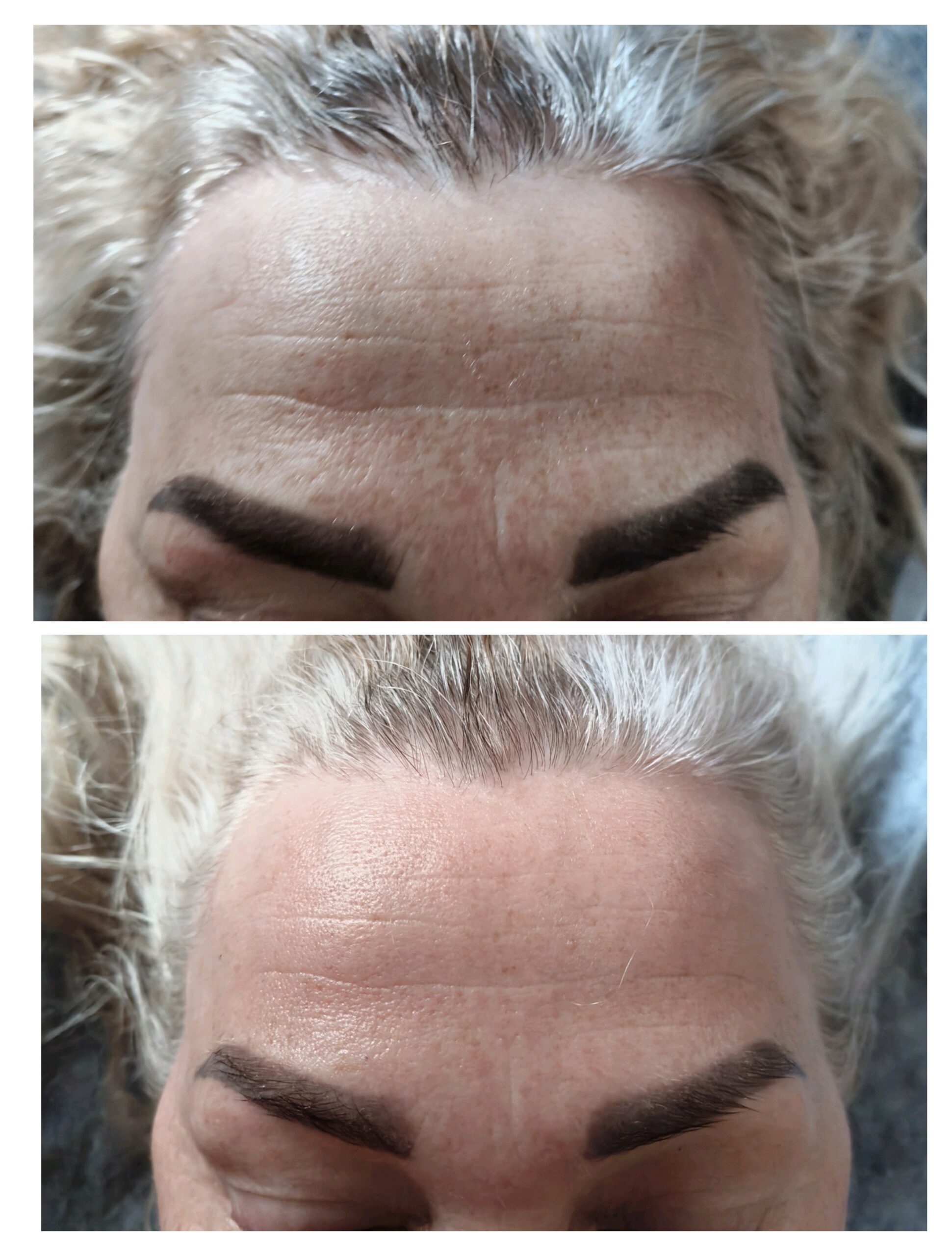 Efekt zabiegu — metamorfoza