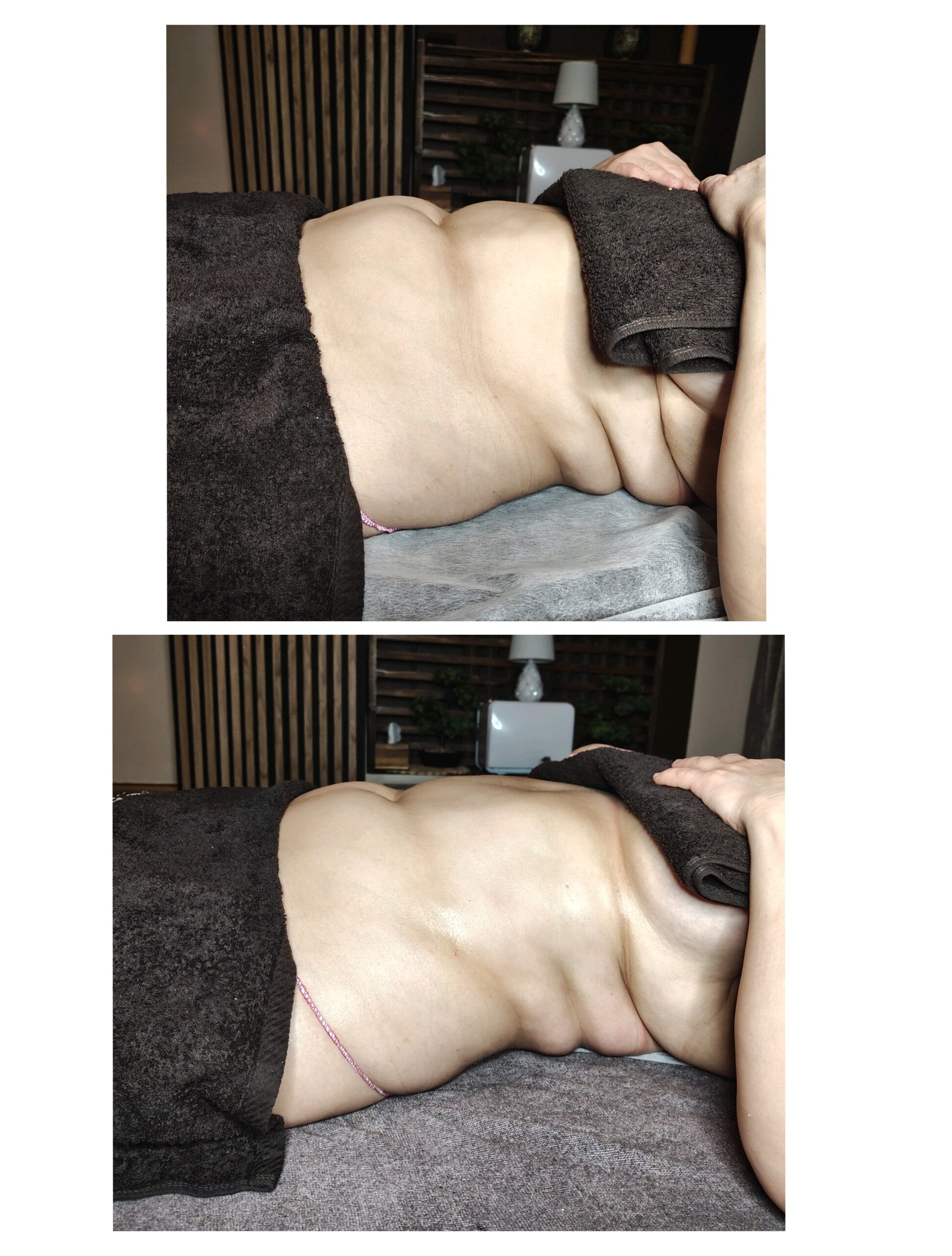 LimfImpact — szkolenie